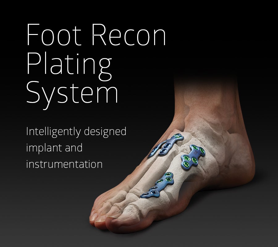 Foot Recon Plating System Unite Foot and Ankle Development site