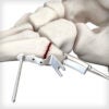 5th Metatarsal Hook Plates - Image 3