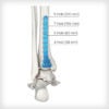 Posterolateral Distal Tibia Plates - Image 3