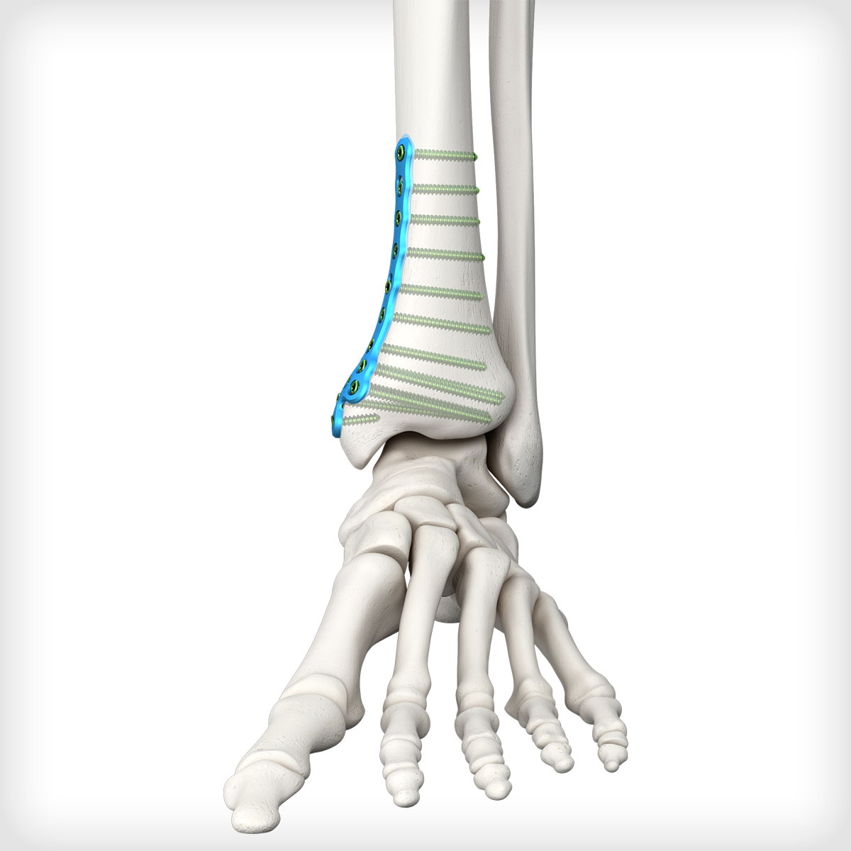 medial malleolus of tibia