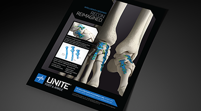 Foot-Recon-Plating-Product-Sheet