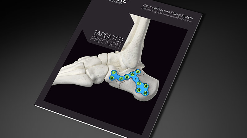 Medline-Unite-Brochure-Calcaneal-Fracture