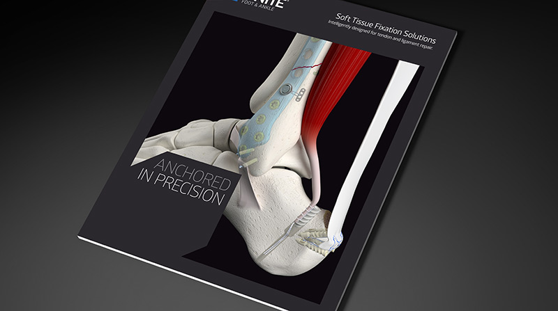 Medline-Unite-Soft-Tissue-Fixation-Brochure