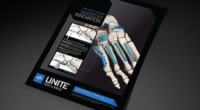 Mini-Foot-Plating-System-Product-Sheet