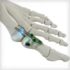 REFLEX® HYBRID Nitinol Implants - Image 4