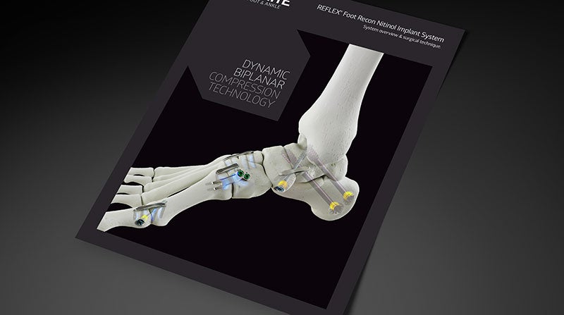 REFLEX_Nitinol_Implant