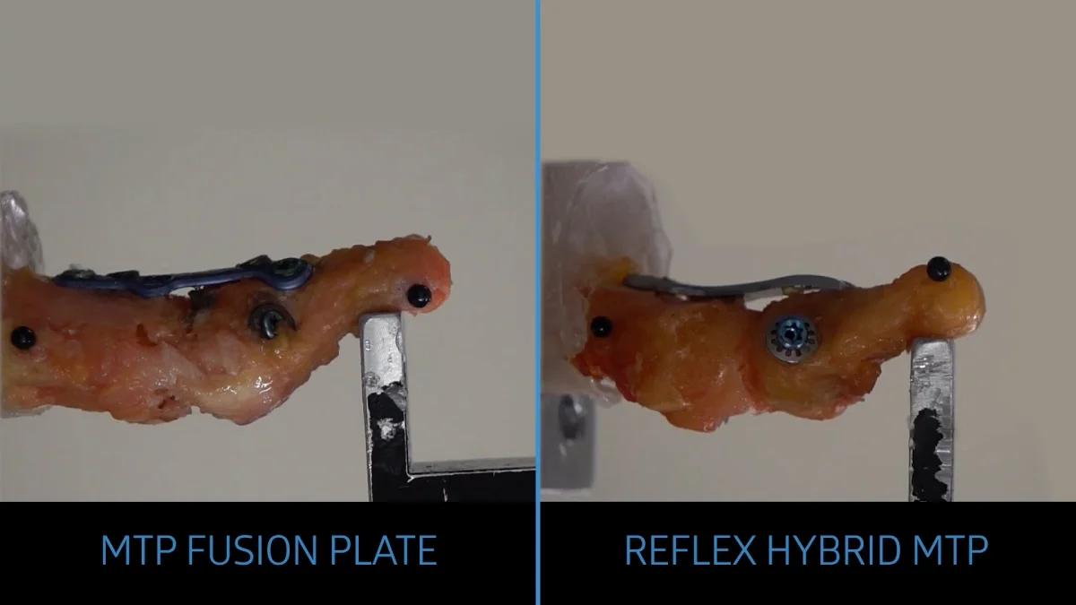 Thumbnail_Image_Hybrid_Head_to_Head_Biomechanical_Testing