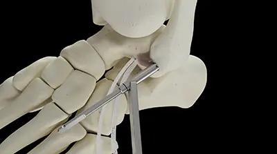 Surg_tech_animation_THUMBNAIL