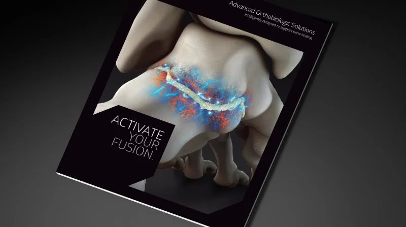 Advanced Orthobiologic Solutions Brochure